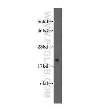 GEMIN6 Rabbit Polyclonal Antibody (12307-2-AP)
