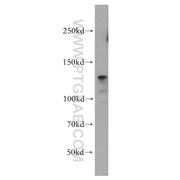 ITGB1 Rabbit Polyclonal Antibody (12594-1-AP)