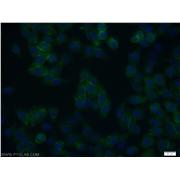 ARMC8 Rabbit Polyclonal Antibody (12653-1-AP)