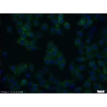 ARMC8 Rabbit Polyclonal Antibody (12653-1-AP)