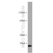 F12 Rabbit Polyclonal Antibody (12551-1-AP)