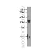 MAOB Rabbit Polyclonal Antibody (12602-1-AP)