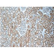 ECOP Rabbit Polyclonal Antibody (12611-1-AP)