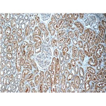 ECOP Rabbit Polyclonal Antibody (12611-1-AP)