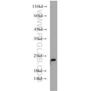 ARL6 Rabbit Polyclonal Antibody (12676-1-AP)