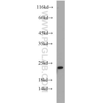 ARL6 Rabbit Polyclonal Antibody (12676-1-AP)