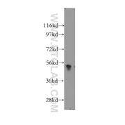 PLXDC2 Rabbit Polyclonal Antibody (12285-1-AP)