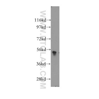PLXDC2 Rabbit Polyclonal Antibody (12285-1-AP)