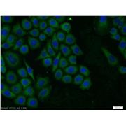 TROVE2 Rabbit Polyclonal Antibody (12718-1-AP)