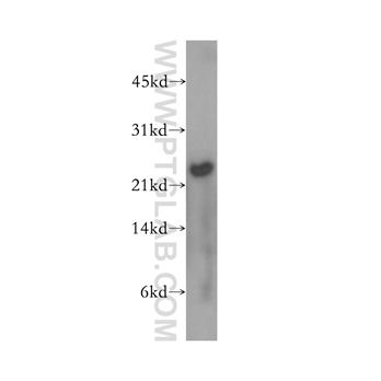 MAD2L2 Rabbit Polyclonal Antibody (12683-1-AP)