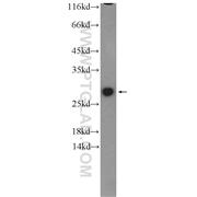 GSTM1 Rabbit Polyclonal Antibody (12412-1-AP)