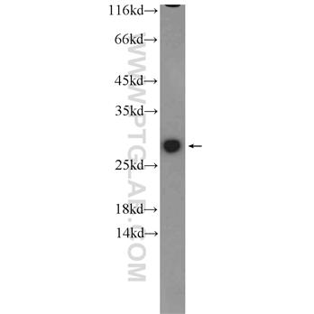GSTM1 Rabbit Polyclonal Antibody (12412-1-AP)