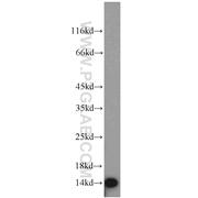 FDX1 Rabbit Polyclonal Antibody (12592-1-AP)