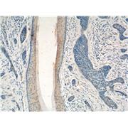 PDCD5 Rabbit Polyclonal Antibody (12456-1-AP)