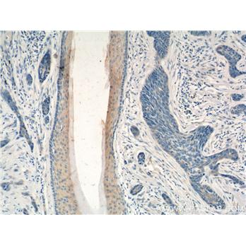 PDCD5 Rabbit Polyclonal Antibody (12456-1-AP)