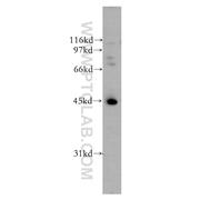 UBE2Q2 Rabbit Polyclonal Antibody (12581-1-AP)