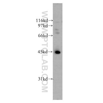 UBE2Q2 Rabbit Polyclonal Antibody (12581-1-AP)
