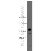 RHOF Rabbit Polyclonal Antibody (12290-1-AP)