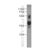 STK38L Rabbit Polyclonal Antibody (12697-1-AP)