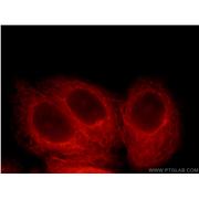 MYCBPAP Rabbit Polyclonal Antibody (12763-1-AP)