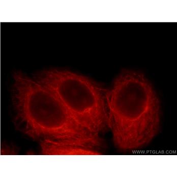 MYCBPAP Rabbit Polyclonal Antibody (12763-1-AP)