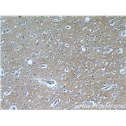 SLC1A1 Rabbit Polyclonal Antibody (12686-1-AP)