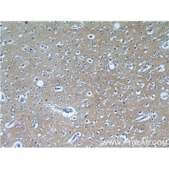 SLC1A1 Rabbit Polyclonal Antibody (12686-1-AP)