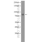 SH3KBP1 Rabbit Polyclonal Antibody (12132-1-AP)