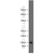 BEX2 Rabbit Polyclonal Antibody (12390-1-AP)