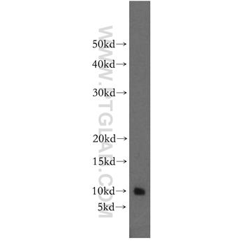 BEX2 Rabbit Polyclonal Antibody (12390-1-AP)