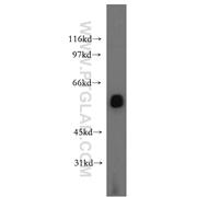 LCAT Rabbit Polyclonal Antibody (12243-1-AP)