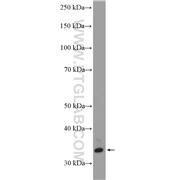 SULT4A1 Rabbit Polyclonal Antibody (12578-1-AP)