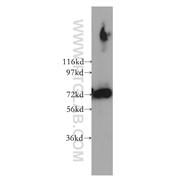 PREPL Rabbit Polyclonal Antibody (12478-1-AP)