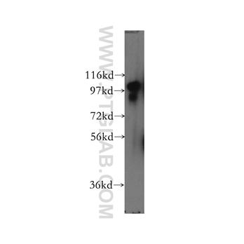 SCYL2 Rabbit Polyclonal Antibody (12325-1-AP)