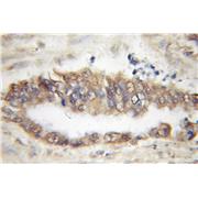 TBL2 Rabbit Polyclonal Antibody (12488-1-AP)