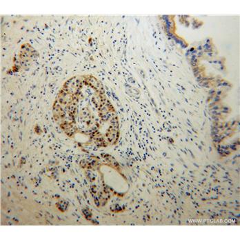 EDIL3 Rabbit Polyclonal Antibody (12580-1-AP)
