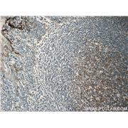 CLU Rabbit Polyclonal Antibody (12289-1-AP)
