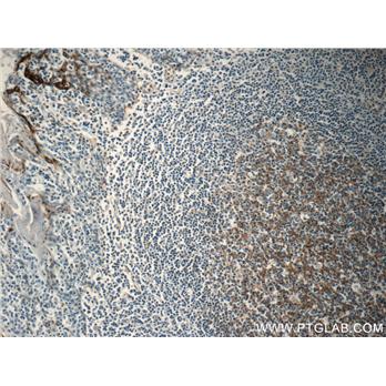 CLU Rabbit Polyclonal Antibody (12289-1-AP)