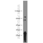TCIRG1 Rabbit Polyclonal Antibody (12649-1-AP)