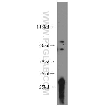 TCIRG1 Rabbit Polyclonal Antibody (12649-1-AP)