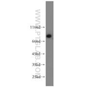 GCLC Rabbit Polyclonal Antibody (12601-1-AP)