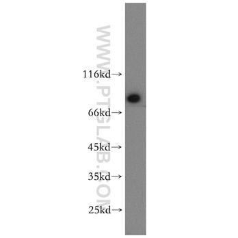GCLC Rabbit Polyclonal Antibody (12601-1-AP)