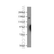 GAK Rabbit Polyclonal Antibody (12147-1-AP)