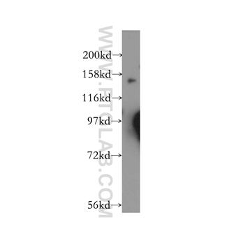 GAK Rabbit Polyclonal Antibody (12147-1-AP)