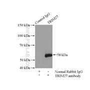 TRIM27 Rabbit Polyclonal Antibody (12205-1-AP)