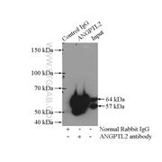 ANGPTL2 Rabbit Polyclonal Antibody (12316-1-AP)