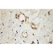 EXOC2 Rabbit Polyclonal Antibody (12751-1-AP)