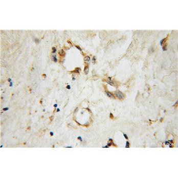 EXOC2 Rabbit Polyclonal Antibody (12751-1-AP)