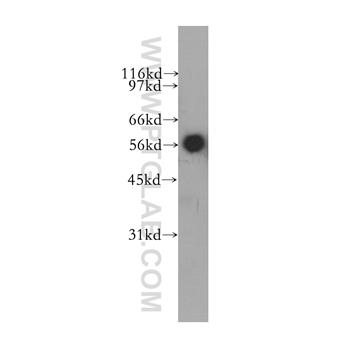 CYB5R4 Rabbit Polyclonal Antibody (12626-1-AP)