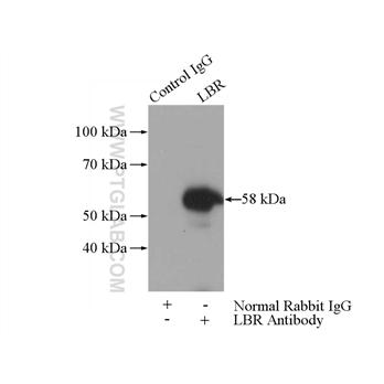 LBR Rabbit Polyclonal Antibody (12398-1-AP)